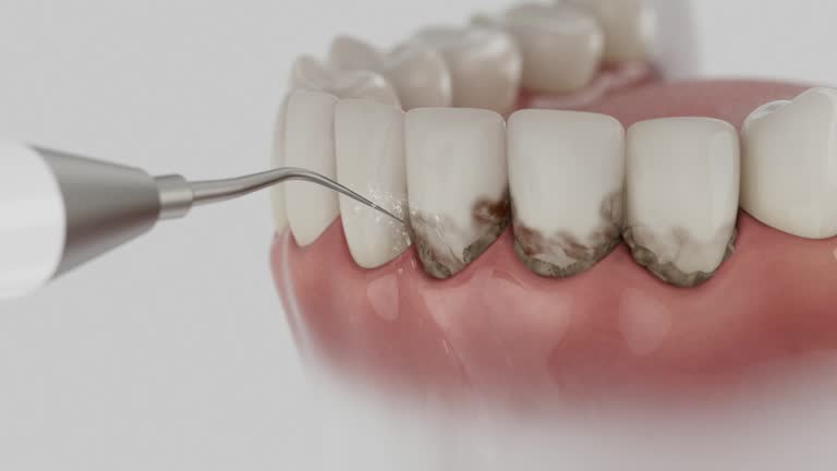 Trusted Dental Crowns And Bridges service in Thomson, GA - Dentist Open Now
